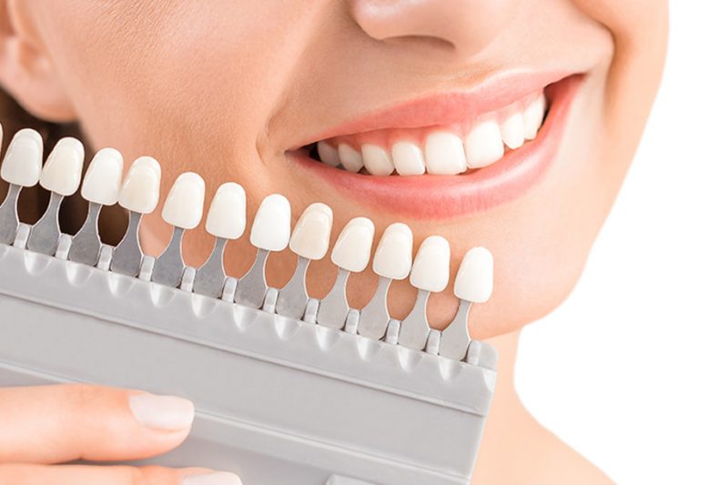 Biện pháp nào có thể làm cho răng sứ và răng thật trở nên đồng màu nhau?
